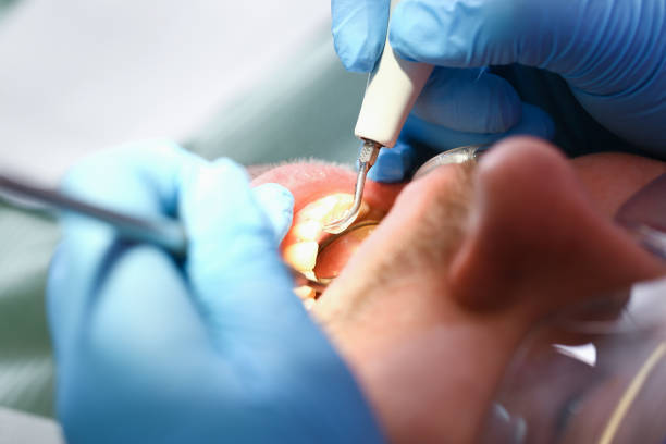 Professional Emergency Dentist in WA