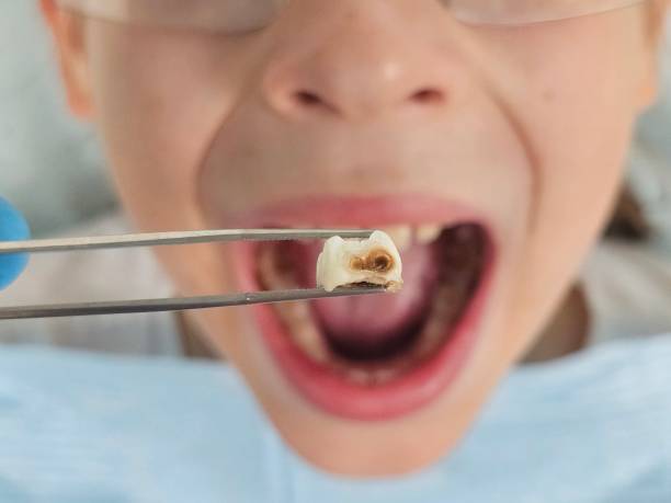 Best Emergency Orthodontic Repairs in Suquamish, WA